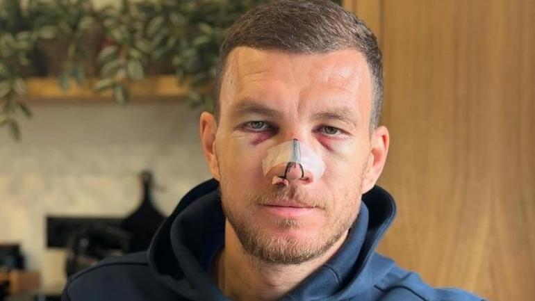 fenerbahce gozler anderson taliscaya cevrildi isler degisti 1 48MrVQOl