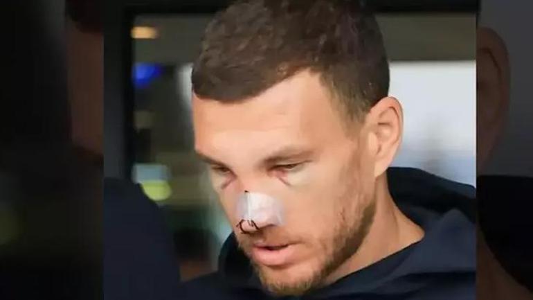 fenerbahceye edin dzekodan guzel haber mac kacirmak istemiyor 0